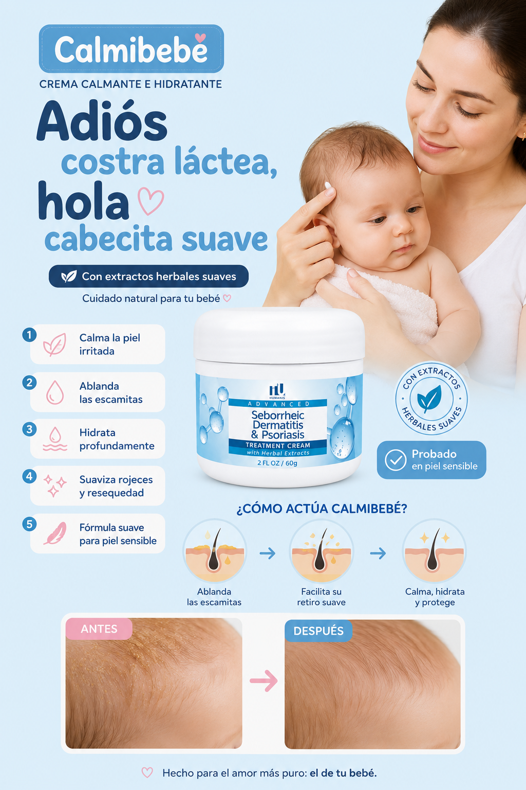 Seborrheic Dermatitis & Psoriasis oferta 2x1